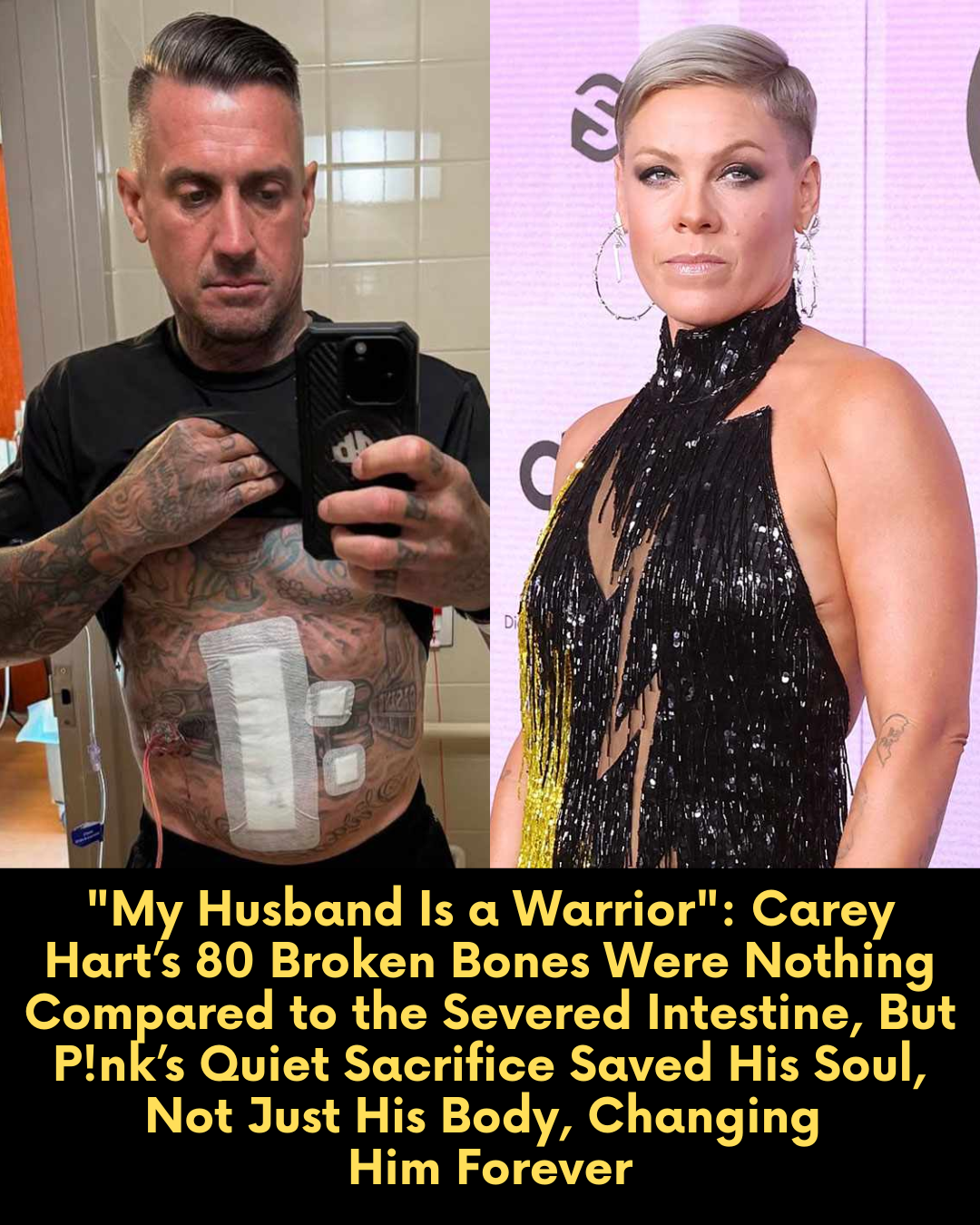 “My Husband Is a Warrior”: Carey Hart’s 80 Broken Bones Were Nothing Compared to the Severed Intestine, But P!nk’s Quiet Sacrifice Saved His Soul, Not Just His Body, Changing  Him Forever