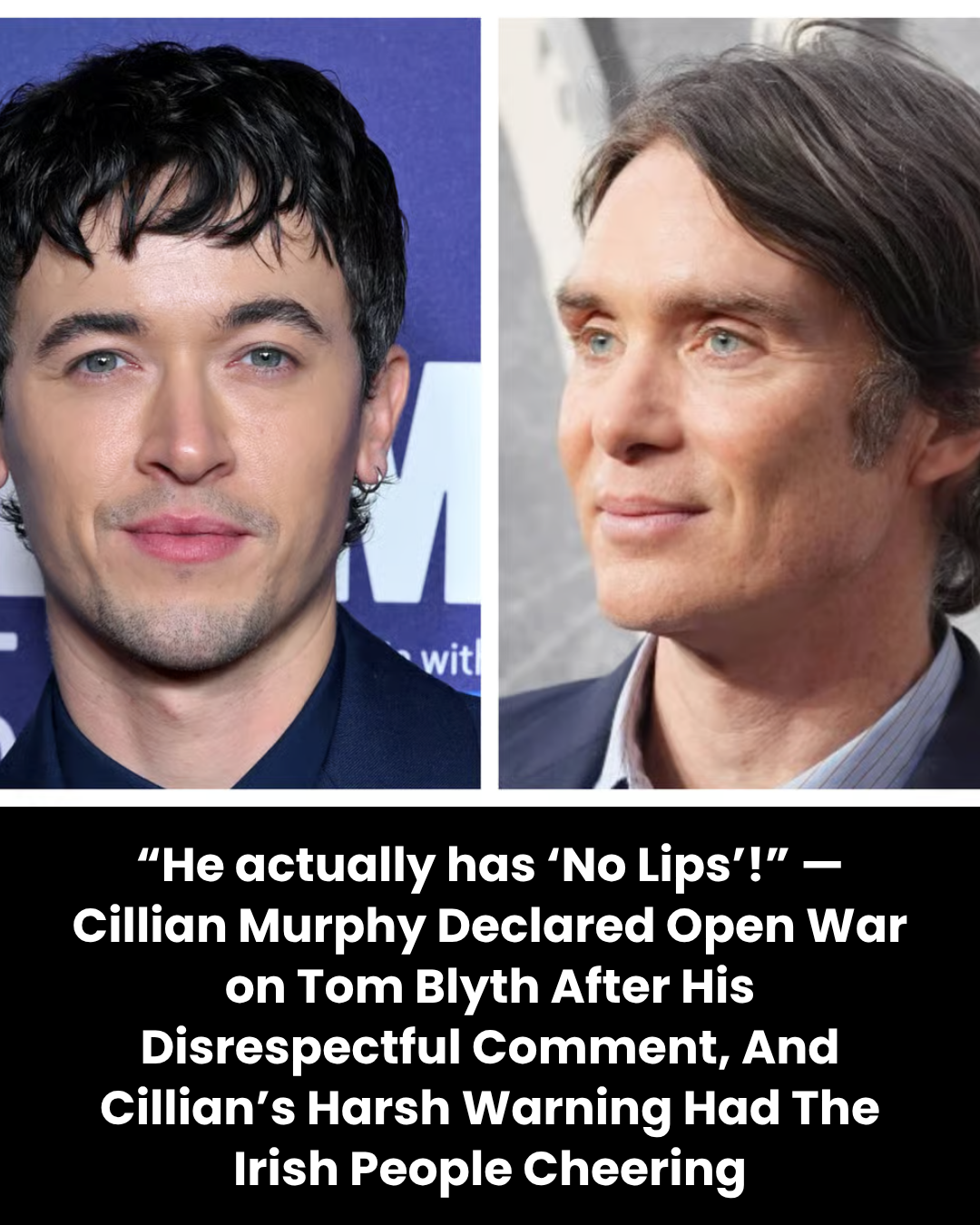 “He actually has ‘No Lips’!” — Cillian Murphy Declared Open War on Tom Blyth After His Disrespectful Comment, And Cillian’s Harsh Warning Had The Irish People Cheering