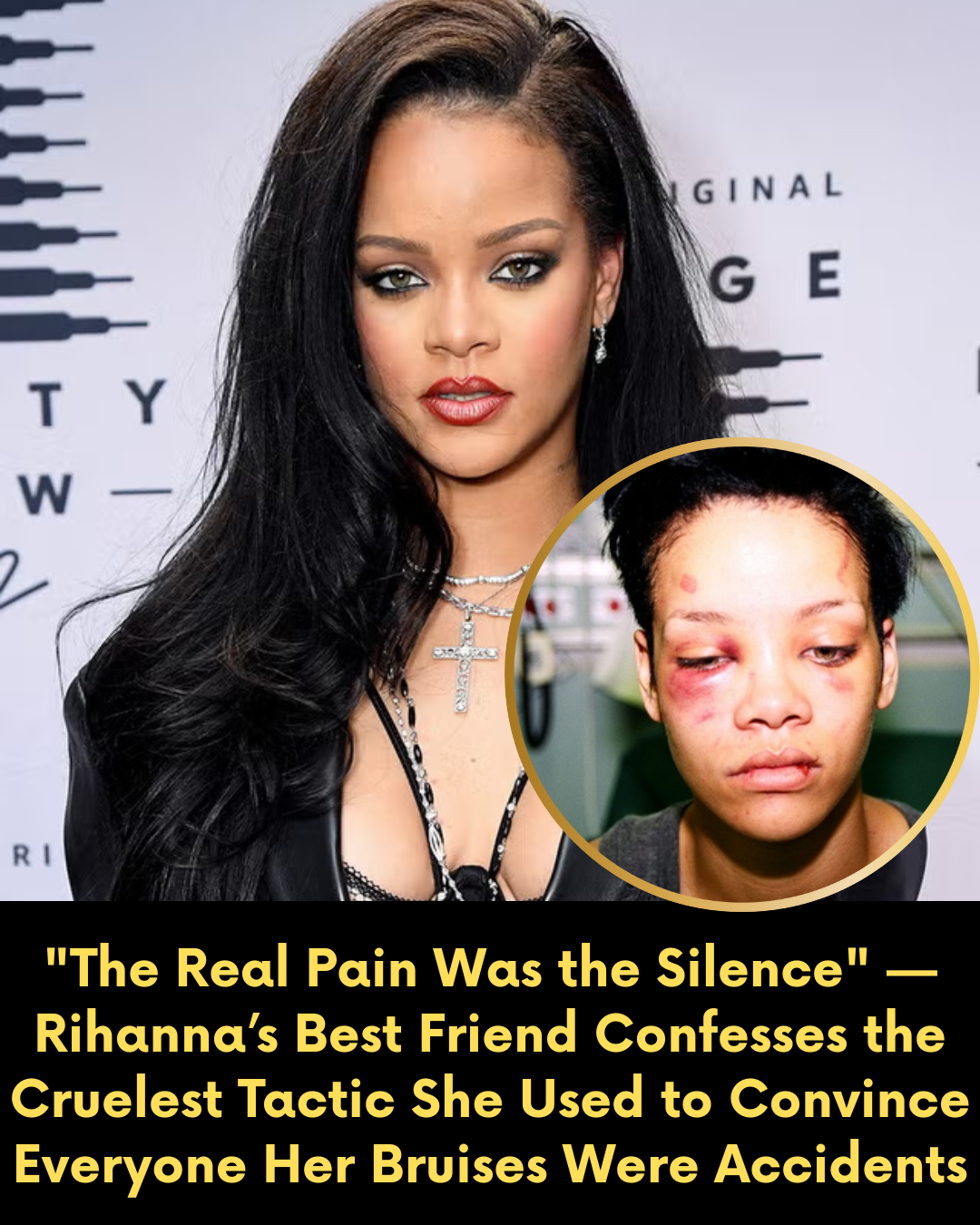 “The Real Pain Was the Silence” — Rihanna’s Best Friend Confesses the Cruelest Tactic She Used to Convince Everyone Her Bruises Were Accidents