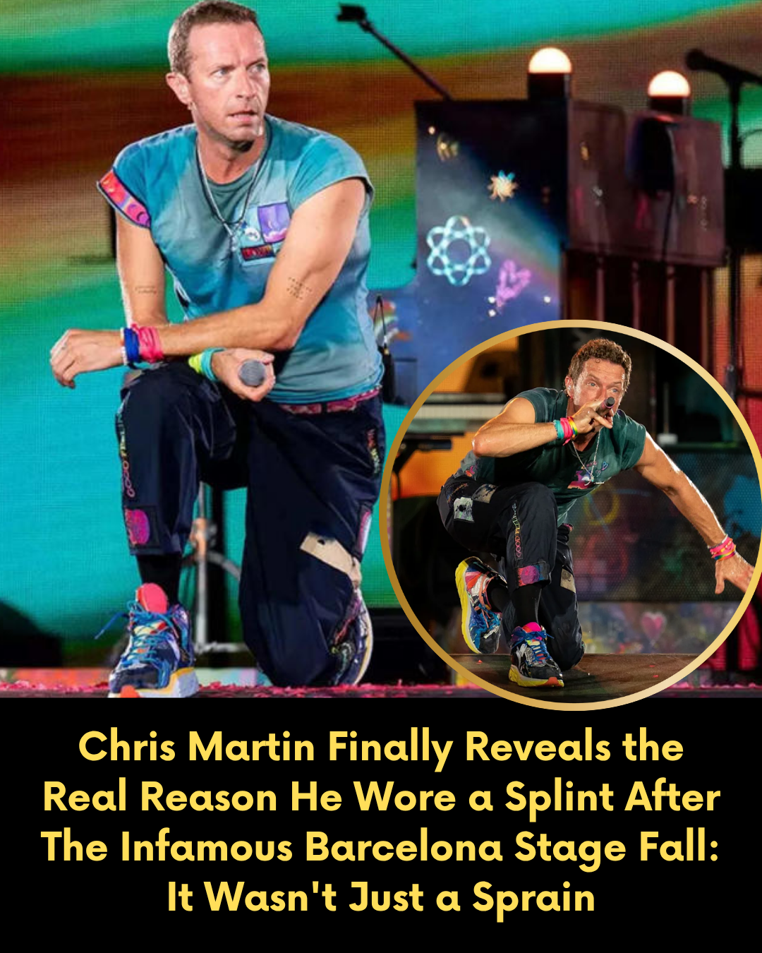 Chris Martin Finally Reveals the Real Reason He Wore a Splint After The Infamous Barcelona Stage Fall: It Wasn’t Just a Sprain