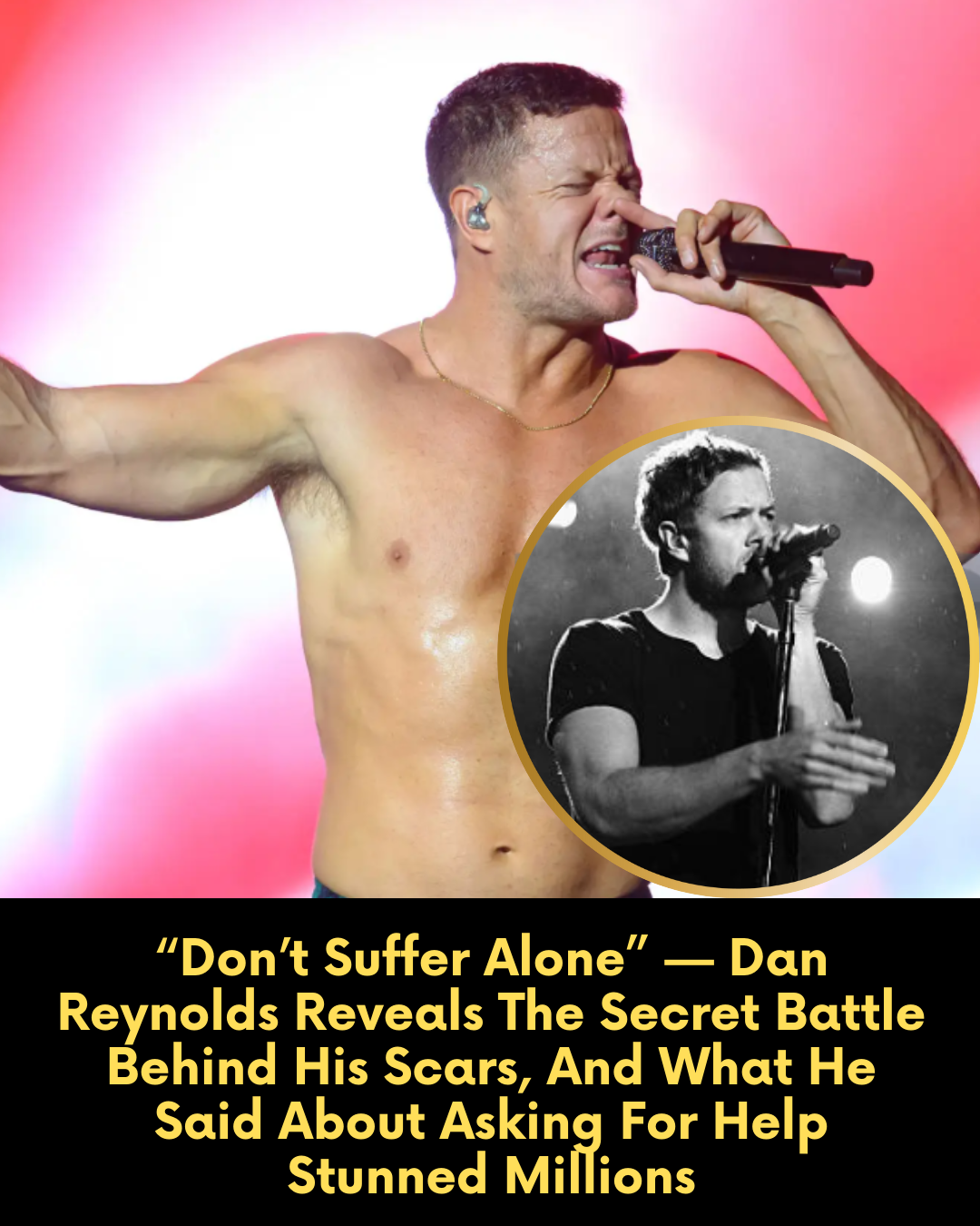 “Don’t Suffer Alone” — Dan Reynolds Reveals The Secret Battle Behind His Scars, And What He Said About Asking For Help Stunned Millions