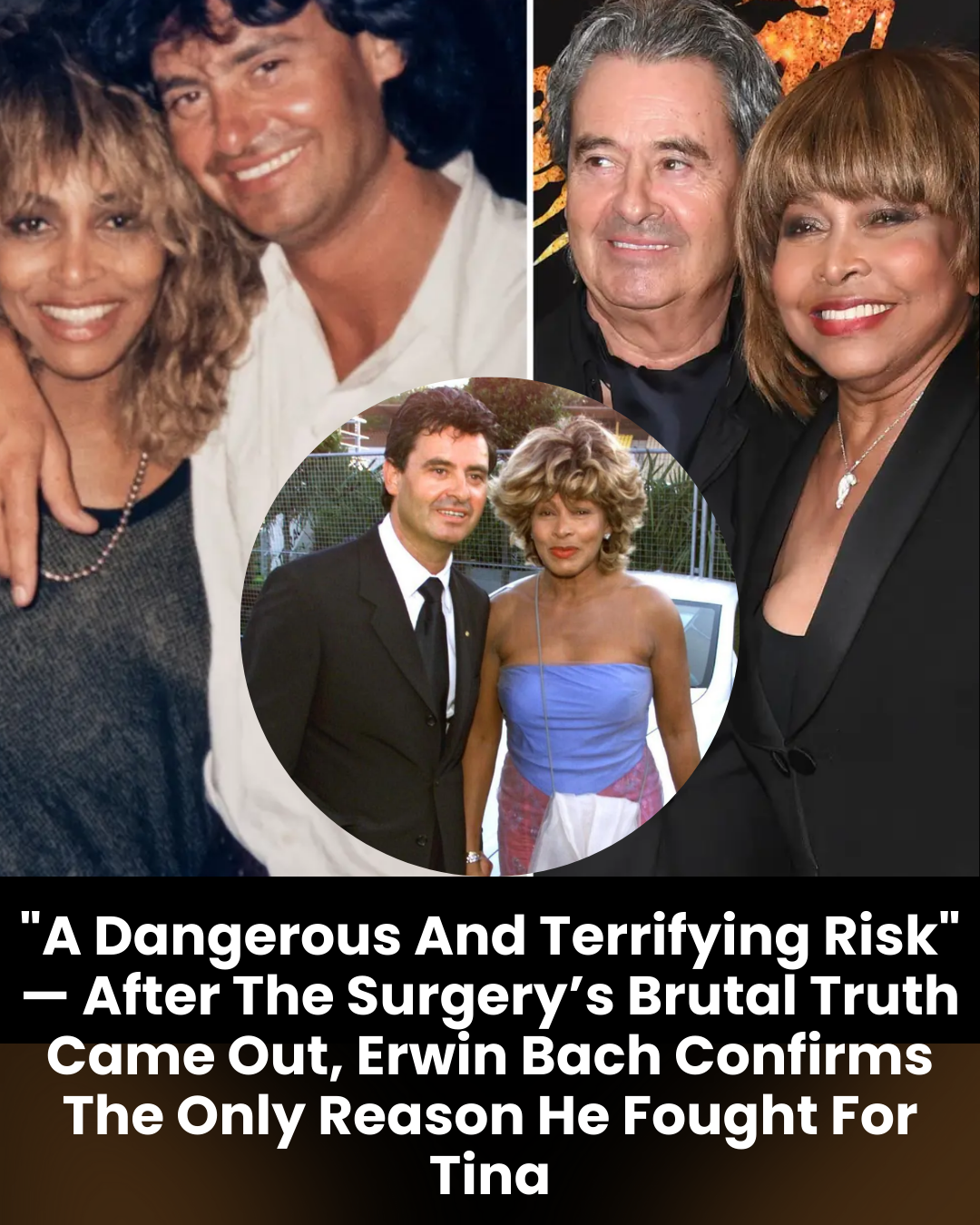 “A Dangerous And Terrifying Risk” — After The Surgery’s Brutal Truth Came Out, Erwin Bach Confirms The Only Reason He Fought For Tina