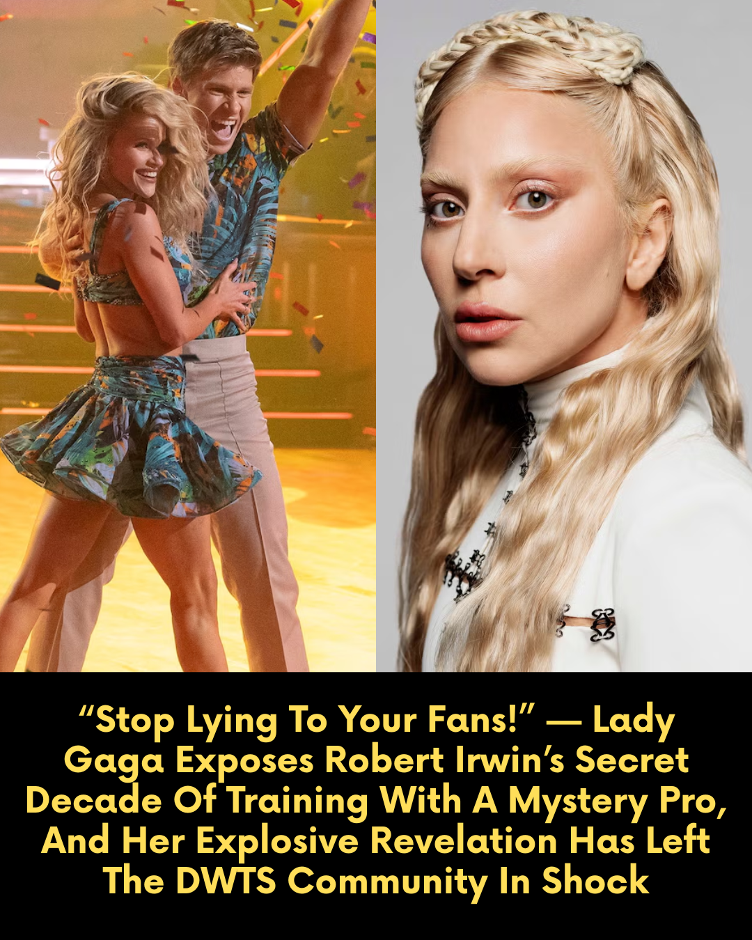 “Stop Lying To Your Fans!” — Lady Gaga Exposes Robert Irwin’s Secret Decade Of Training With A Mystery Pro, And Her Explosive Revelation Has Left The DWTS Community In Shock