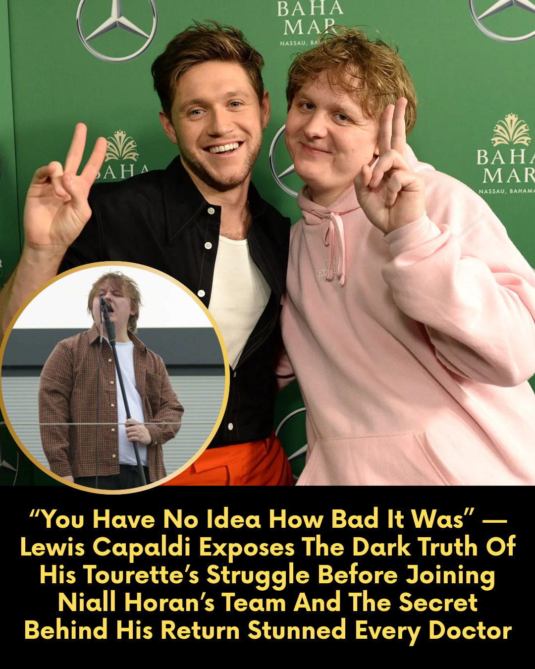 “You Have No Idea How Bad It Was” — Lewis Capaldi Exposes The Dark Truth Of His Tourette’s Struggle Before Joining Niall Horan’s Team And The Secret Behind His Return Stunned Every Doctor