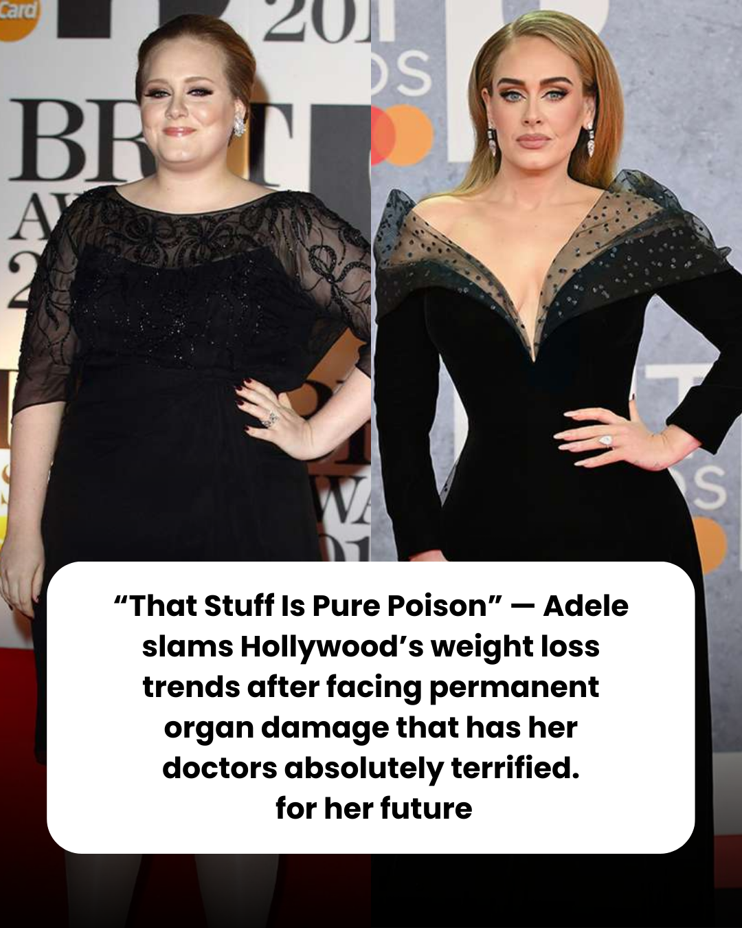 “That Stuff Is Pure Poison” — Adele slams Hollywood’s weight loss trends after facing permanent organ damage that has her doctors absolutely terrified.  for her future