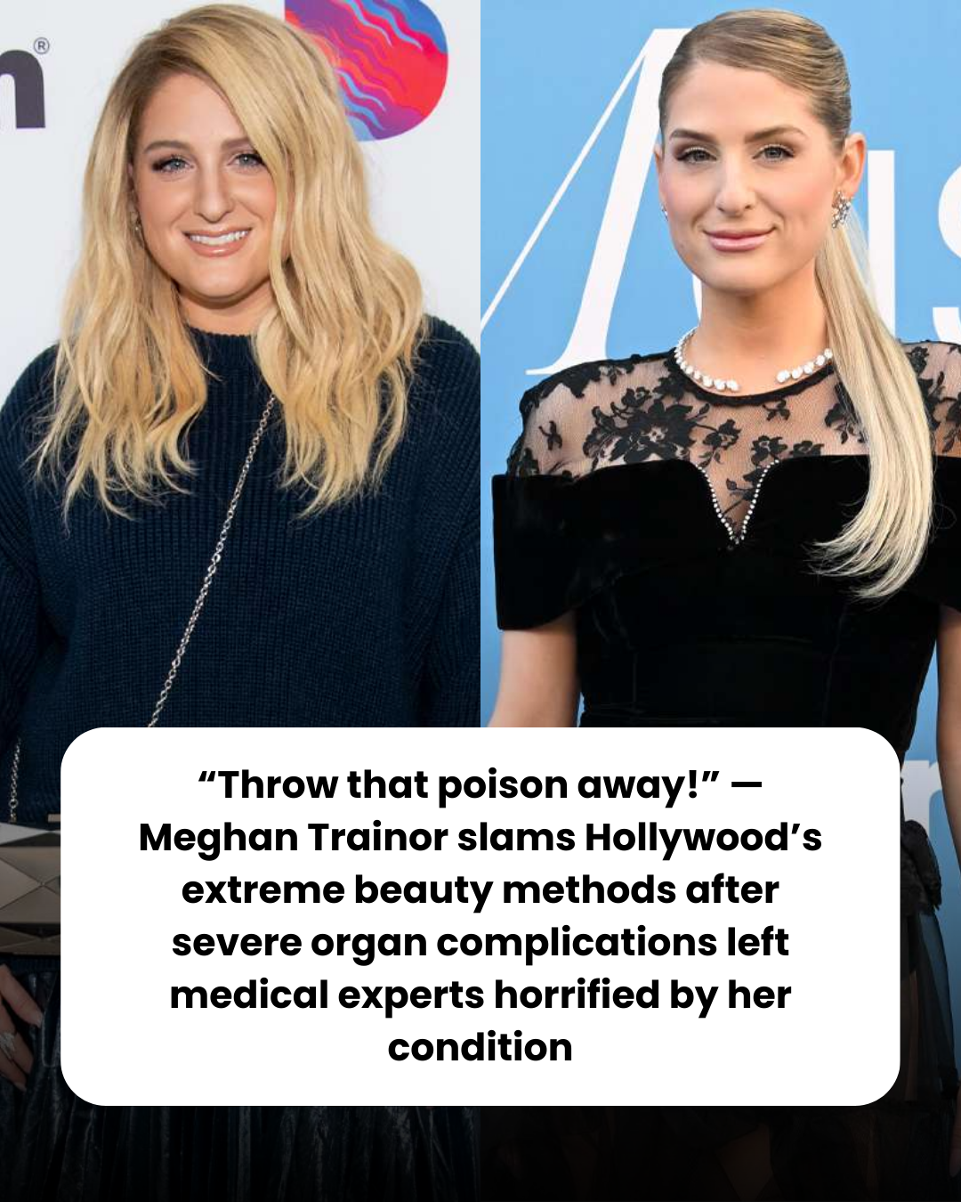 “Throw that poison away!” — Meghan Trainor slams Hollywood’s extreme beauty methods after severe organ complications left medical experts horrified by her condition