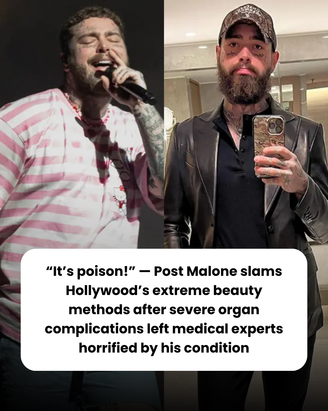 “It’s poison!” — Post Malone slams Hollywood’s extreme beauty methods after severe organ complications left medical experts horrified by his condition