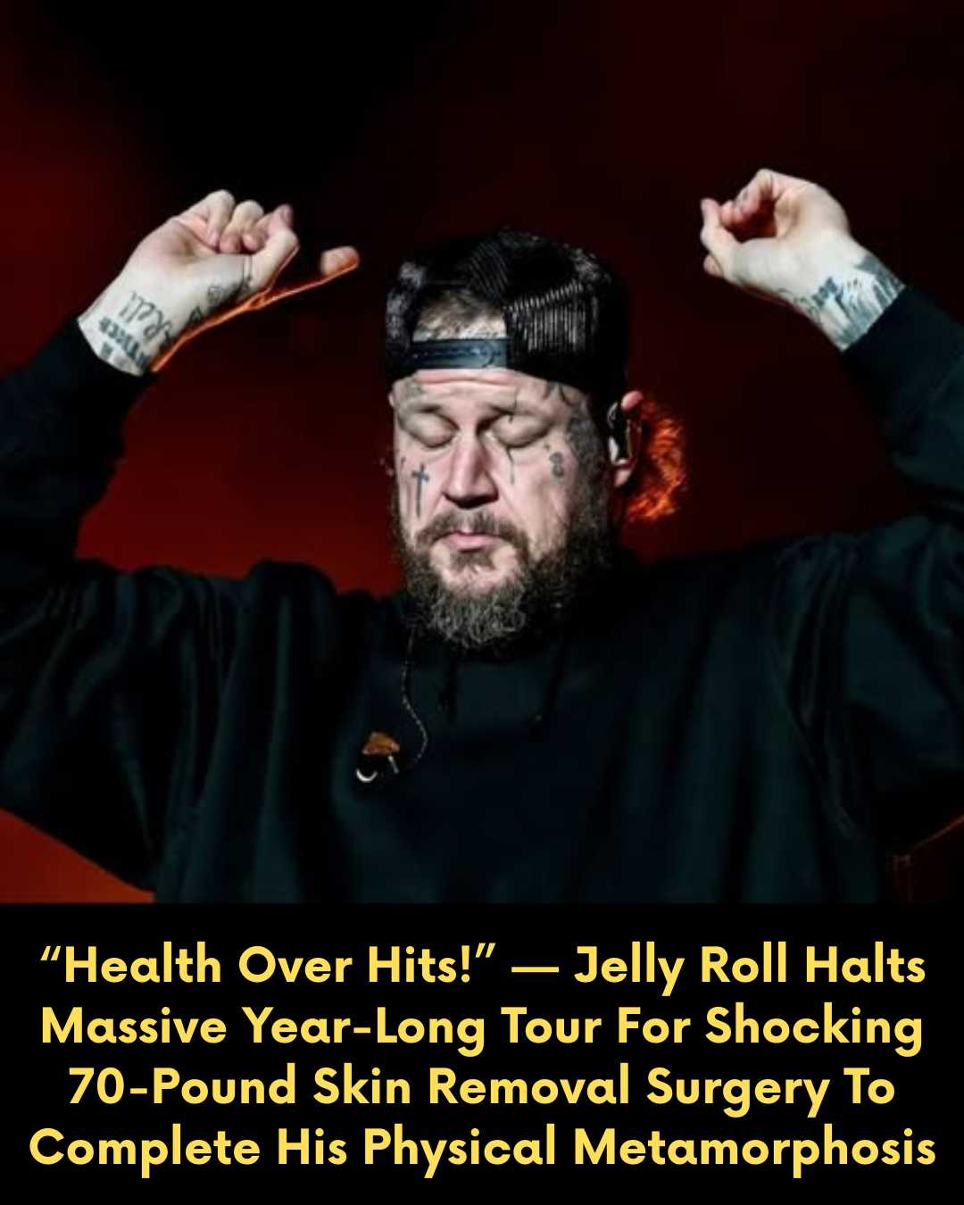 “Health Over Hits!” — Jelly Roll Halts Massive Year-Long Tour For Shocking 70-Pound Skin Removal Surgery To Complete His Physical Metamorphosis