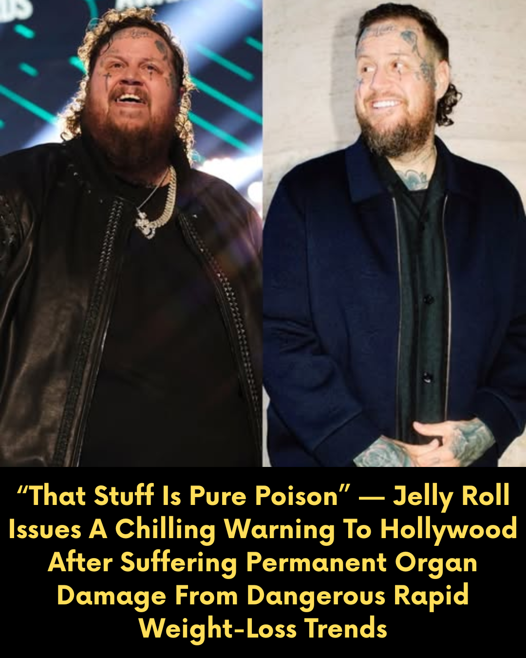 “That Stuff Is Pure Poison” — Jelly Roll Issues A Chilling Warning To Hollywood After Suffering Permanent Organ Damage From Dangerous Rapid Weight-Loss Trends