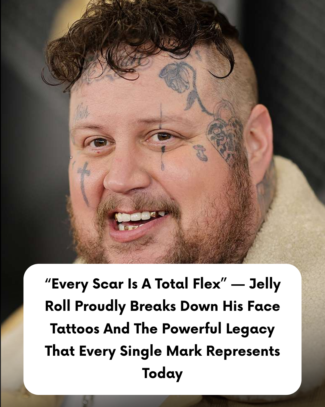 “Every Scar Is A Total Flex” — Jelly Roll Proudly Breaks Down His Face Tattoos And The Powerful Legacy That Every Single Mark Represents Today
