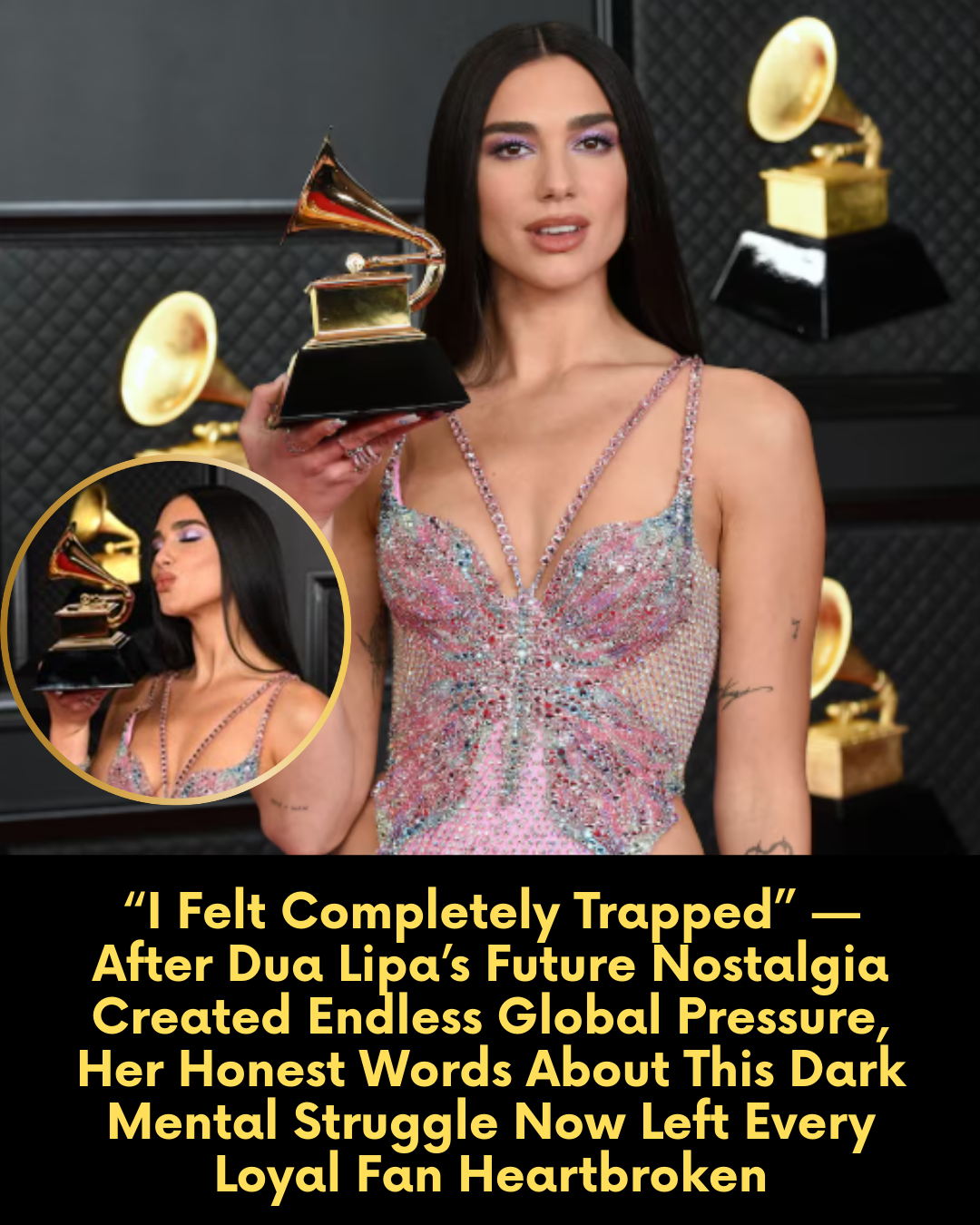 “I Felt Completely Trapped” — After Dua Lipa’s Future Nostalgia Created Endless Global Pressure, Her Honest Words About This Dark Mental Struggle Now Left Every Loyal Fan Heartbroken