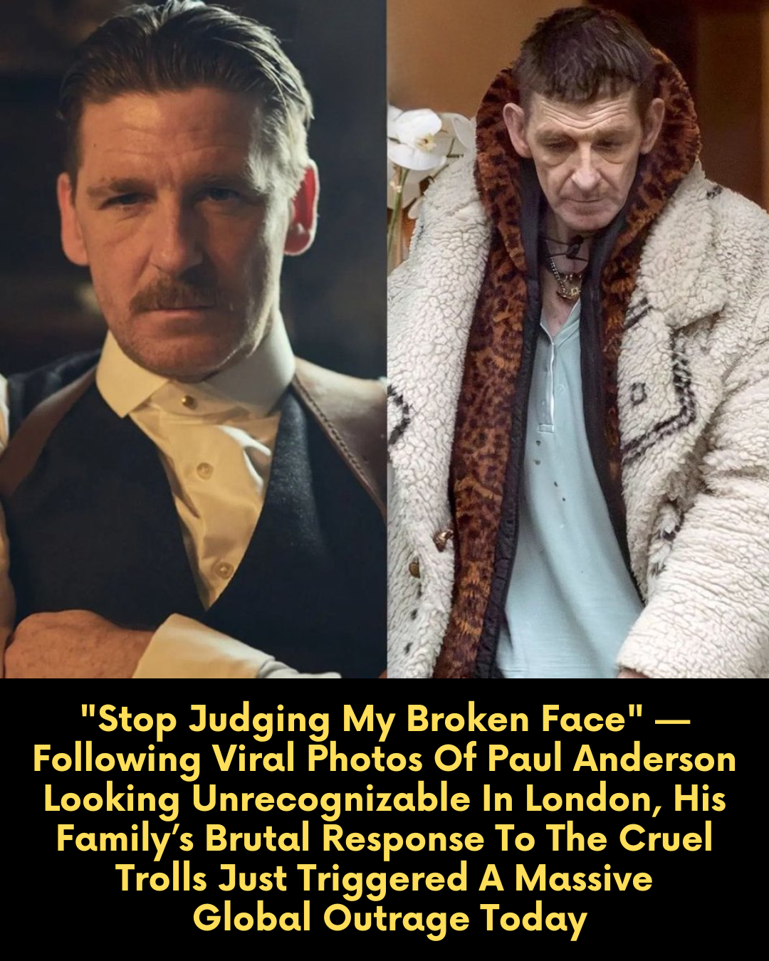 “Stop Judging My Broken Face” — Following Viral Photos Of Paul Anderson Looking Unrecognizable In London, His Family’s Brutal Response To The Cruel Trolls Just Triggered A Massive Global Outrage Today